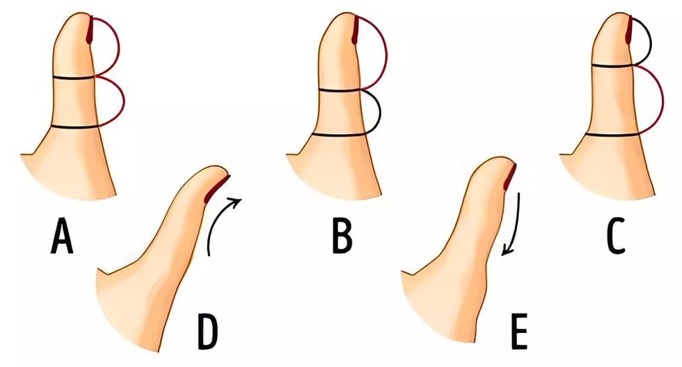The shape of your thumb will reveal how you think and who you are.