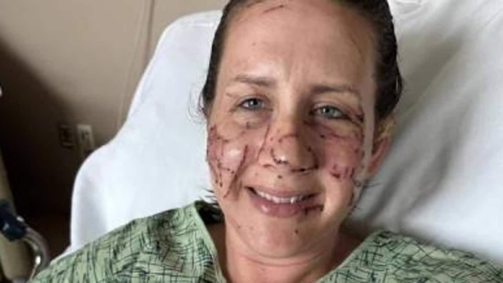 Montana woman recalls ‘life-threatening’ attack by an otter in Jefferson River