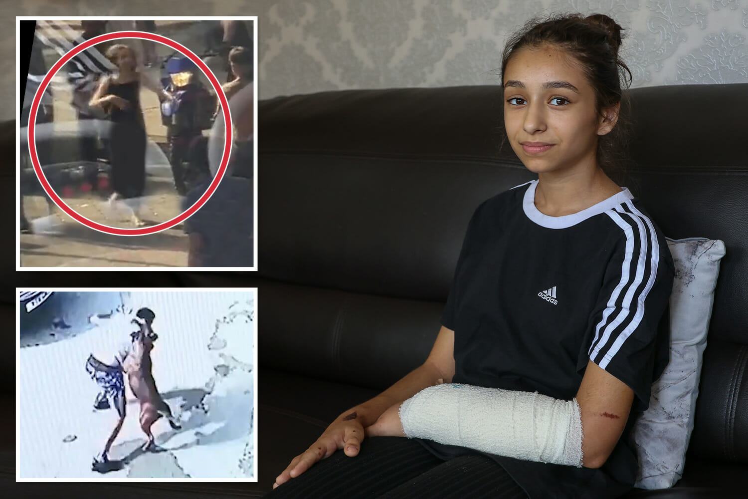 I thought I'd die when I was mauled by savage XL Bully, 11-year-old girl reveals as new vid shows attack that injured 3