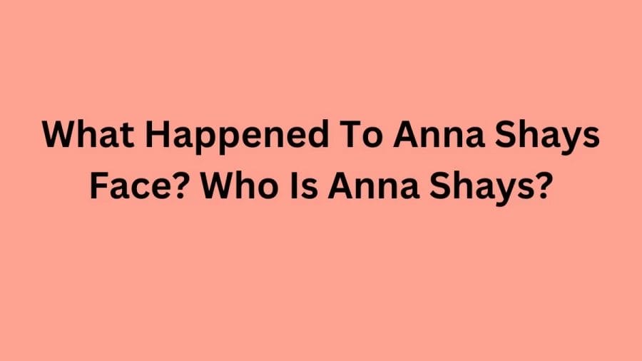 What Happened To Anna Shays Face? Who Is Anna Shays?