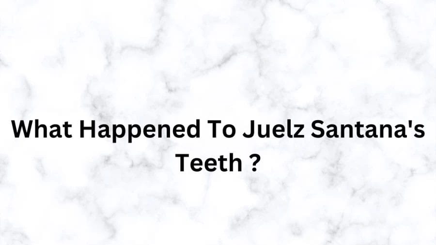 What Happened To Juelz Santana Teeth, Juelz Santana Teeth Before And After