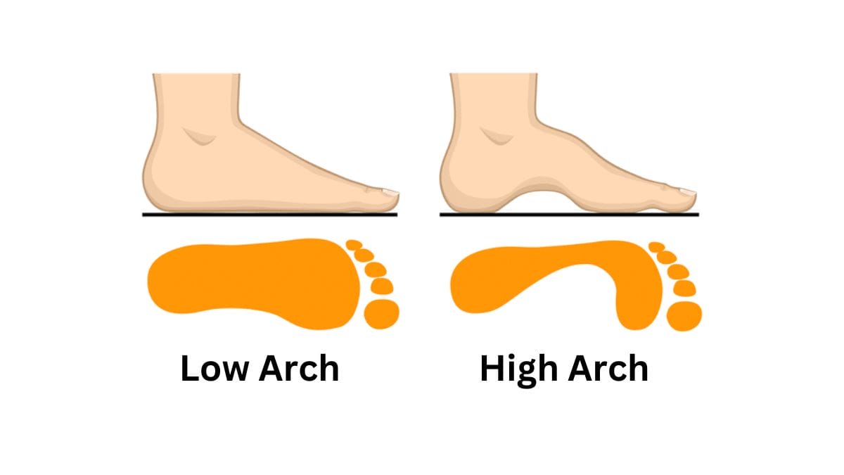 Feet Arch Personality Test