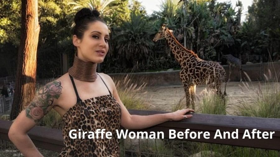 Giraffe Woman Before And After, Look At The Images Of Giraffe Woman After Removing Her Neck Ring