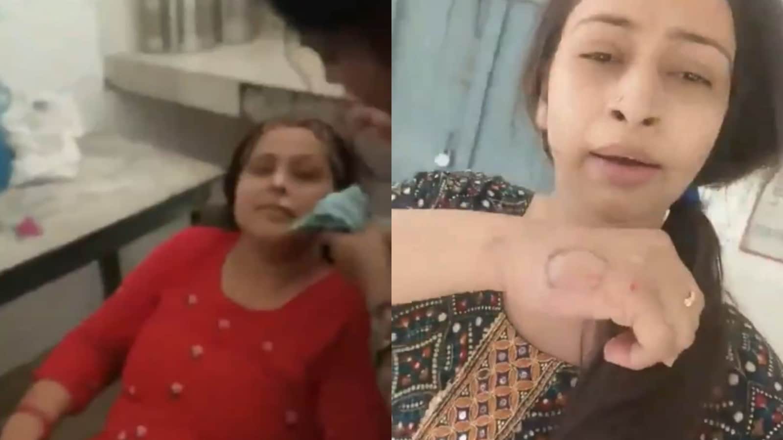 UP school principal caught getting a facial done on campus, bites teacher who recorded video